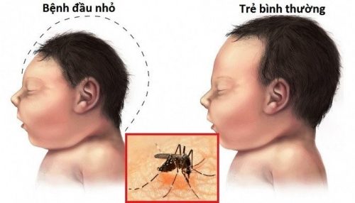 dich-zika-tiep-tuc-lan-rong-tai-ho-chi-minh