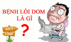 Bị lòi dom sau sinh có sao không? loi-dom-va-cach-chua-hieu-qua-nhat (1)