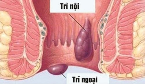 tri-noi-khac-tri-ngoai-nhu-the-nao-02