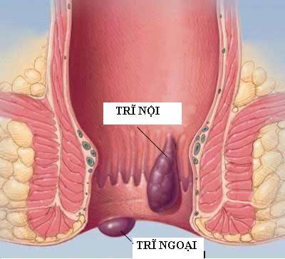 tri-noi-khac-tri-ngoai-nhu-the-nao